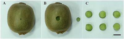 Proteomic Analysis of Kiwifruit in Response to the Postharvest Pathogen, Botrytis cinerea